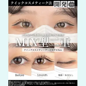 湘南美容クリニック 大阪梅田院 横谷 仁彦医師の症例