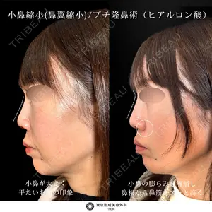 症例