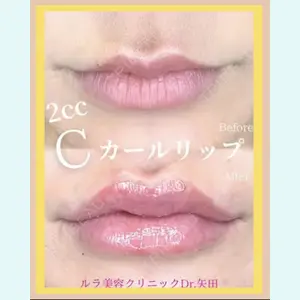ルラ美容クリニック 京都院 矢田 玲奈医師の症例