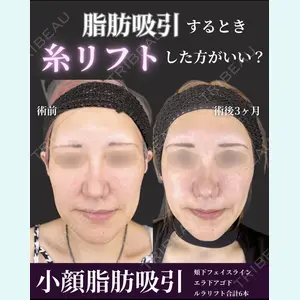 症例