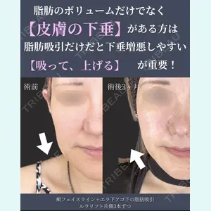 症例