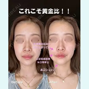 ルラ美容クリニック 京都院 矢田 玲奈医師の症例