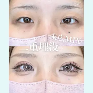 症例