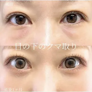 症例