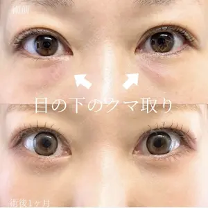 症例