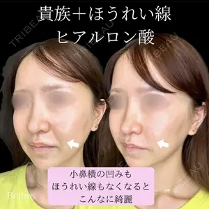症例