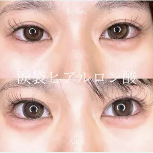 症例