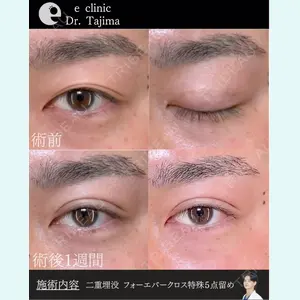 eクリニック 金沢本院 田嶋隼也医師の症例