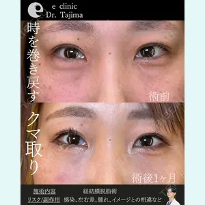 eクリニック 金沢本院 田嶋隼也医師の症例