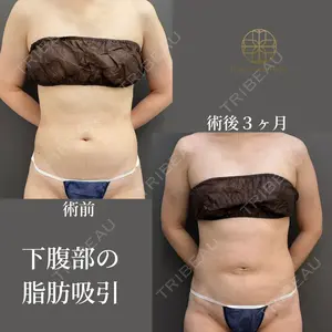 吉井クリニック 吉井 健吾医師の症例