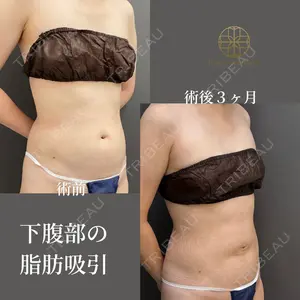 吉井クリニック 吉井 健吾医師の症例