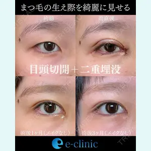 eクリニック 金沢本院 田嶋隼也医師の症例