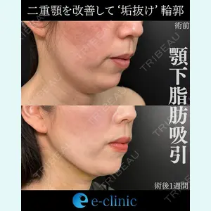 eクリニック 金沢本院 田嶋隼也医師の症例