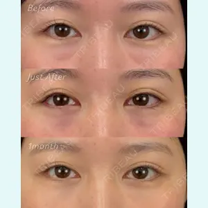 AI Beauty Clinic （エーアイ美容クリニック） 尾崎 宥文医師の症例