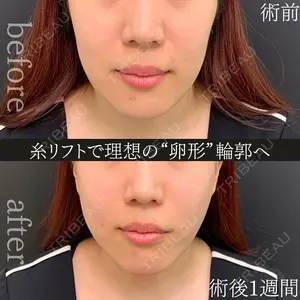eクリニック 金沢本院 田嶋隼也医師の症例