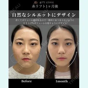 gift clinic 能登谷 翔医師の症例