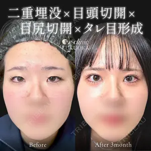 症例