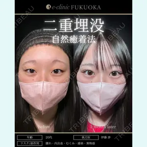 症例