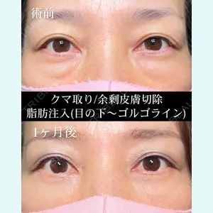 HAAB×DREAM BEAUTY CLINIC 東京本院の症例