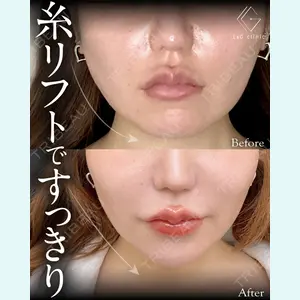 症例