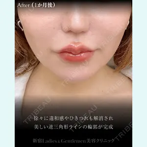 症例