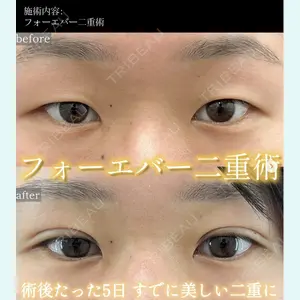 症例