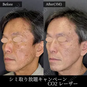 麹町皮ふ科・形成外科クリニック 安藤 玲奈医師の症例