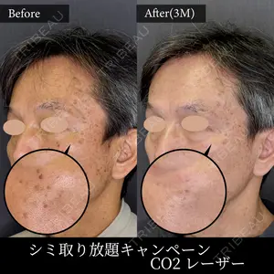 麹町皮ふ科・形成外科クリニック 安藤 玲奈医師の症例