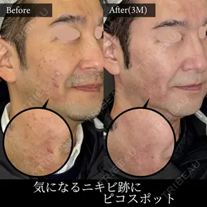 麹町皮ふ科・形成外科クリニック 安藤 玲奈医師の症例