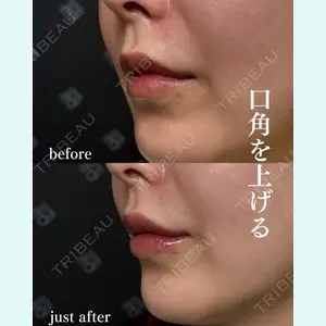 EMMO FACE CLINIC 大阪梅田院 神谷 一成医師の症例