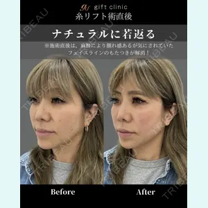 gift clinic 能登谷 翔医師の症例