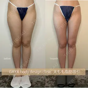 GAYA body design clinicの症例