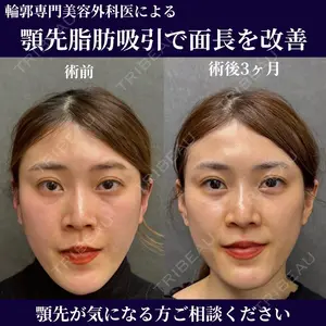 ネビュラクリニック 京都院 岸 大輔医師の症例