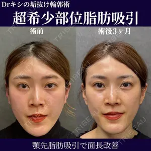 ネビュラクリニック 京都院 岸 大輔医師の症例