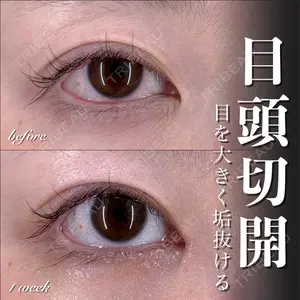 EMMO FACE CLINIC 大宮院 百瀬 直也医師の症例