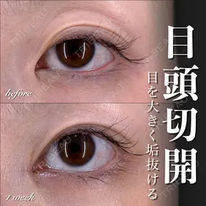 EMMO FACE CLINIC 大宮院 百瀬 直也医師の症例