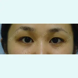 表参道スキンクリニック 沖縄院 佐藤美博 医師の症例