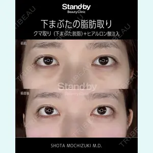 望月 聖太医師の症例