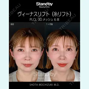 Stand by Beauty Clinic 望月 聖太医師の症例