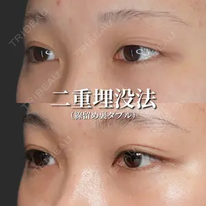 症例