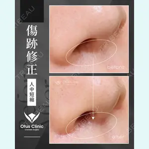 症例