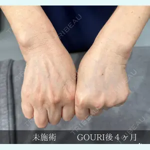 BIANCA銀座 明石 仙姫医師の症例