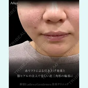 症例