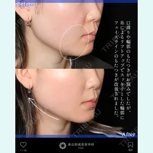 東京形成美容外科 船橋院 山崎 修吾医師の症例