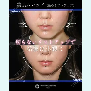 症例
