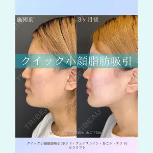 ルラ美容クリニック 札幌院 佐藤 雄紀医師の症例