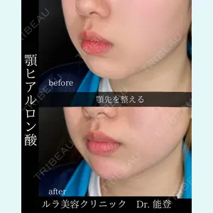ルラ美容クリニック 札幌院 能登 貴弘医師の症例