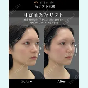 gift clinic 能登谷 翔医師の症例
