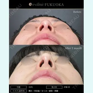 eクリニック 福岡院 伊藤 渉医師の症例