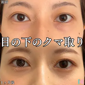 症例